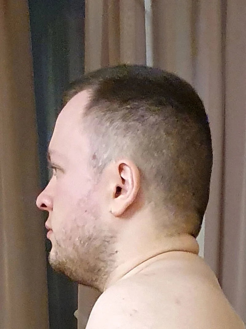 До