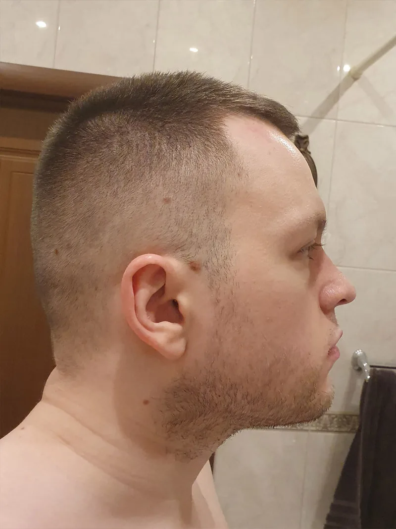 После