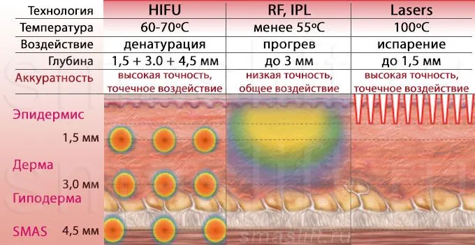 Таблица сравнения процедур