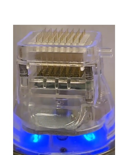 Эффект от процедуры