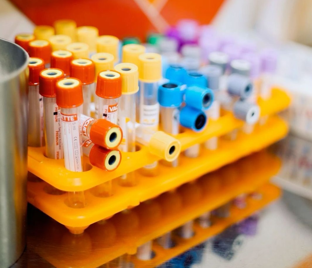 Фото - АНАЛИЗЫ