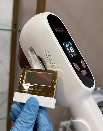 Фото Фотомоложение лицо