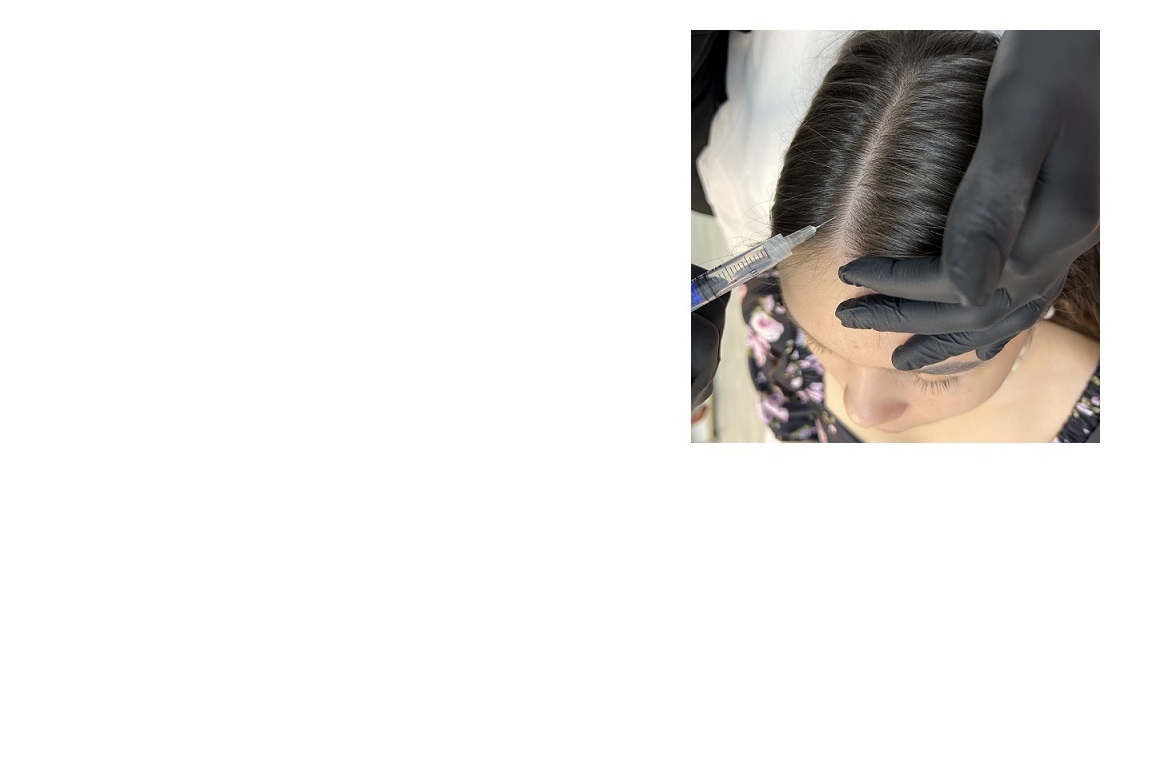 Трихология