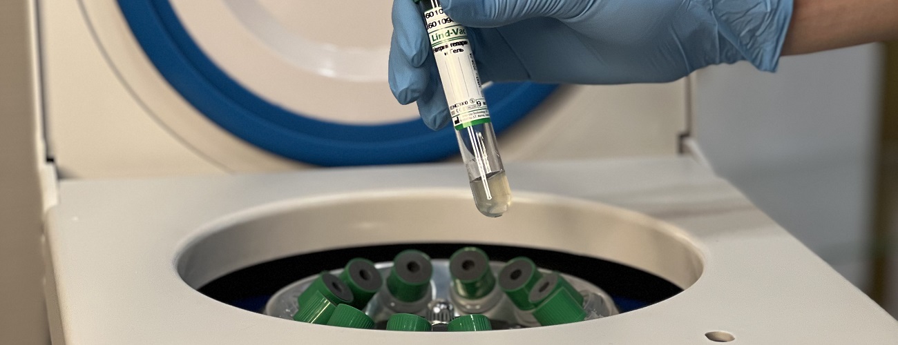 Перхоть и себорейный дерматит